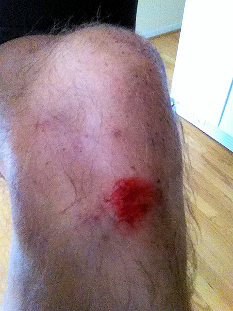 Pardon the hairy leg